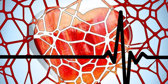 Graphic image of heart with plaque and EKG rhythm